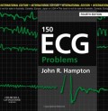 150 ECG Problems
