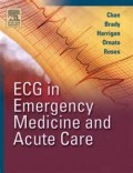 ECG in emergency medicine and acute care