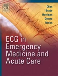 ECG in emergency medicine and acute care