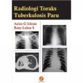 Radiologi toraks : tuberkulosis paru