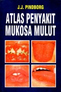 Atlas penyakit mukosa mulut